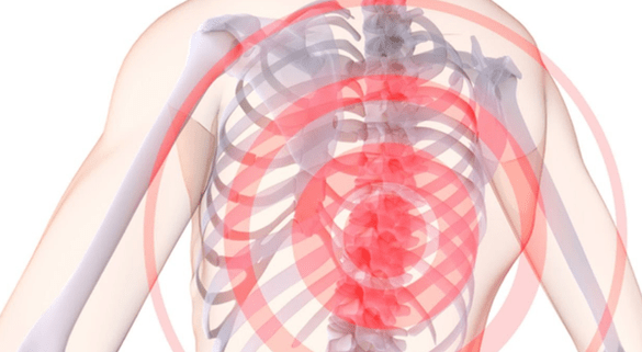 durere la nivelul coloanei vertebrale cu osteocondroză toracică